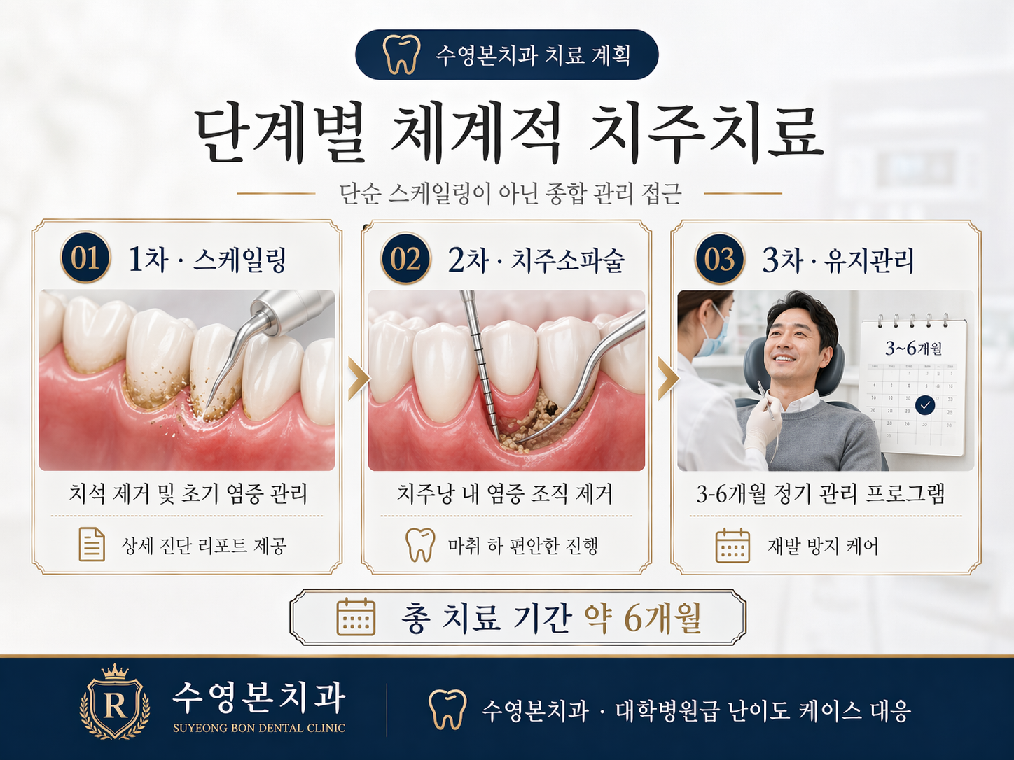 수영역치과 치주치료 3단계 스케일링 치주소파술 유지관리 계획