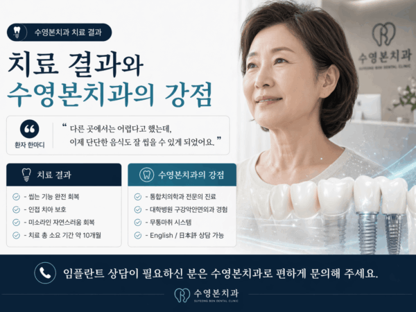 수영구치과 임플란트 재수술, 뼈이식 동반 어금니 회복 사례