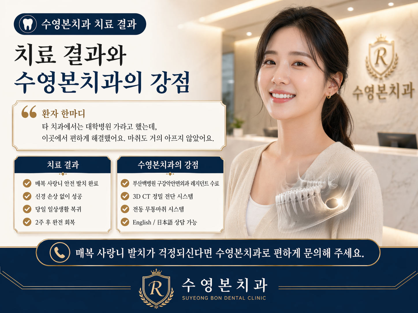 수영구치과 매복 사랑니 발치 결과 수영본치과 구강외과 강점